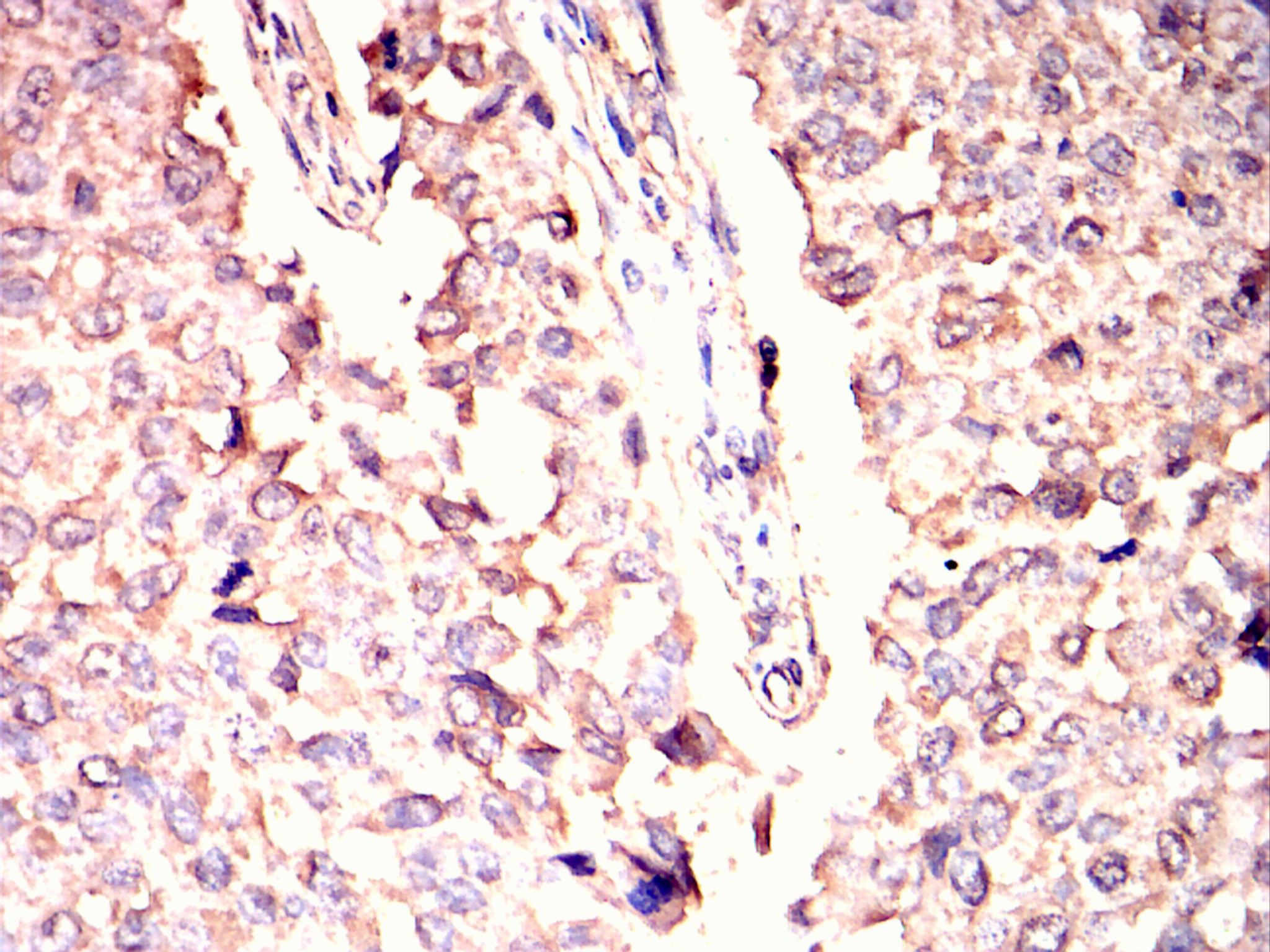 		IHC